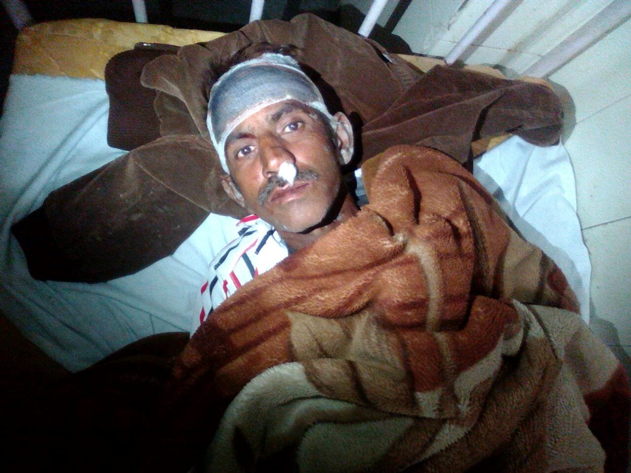 मामूली बात को लेकर फावड़ा से युवक पर प्राणाघातक हमला | New India Times