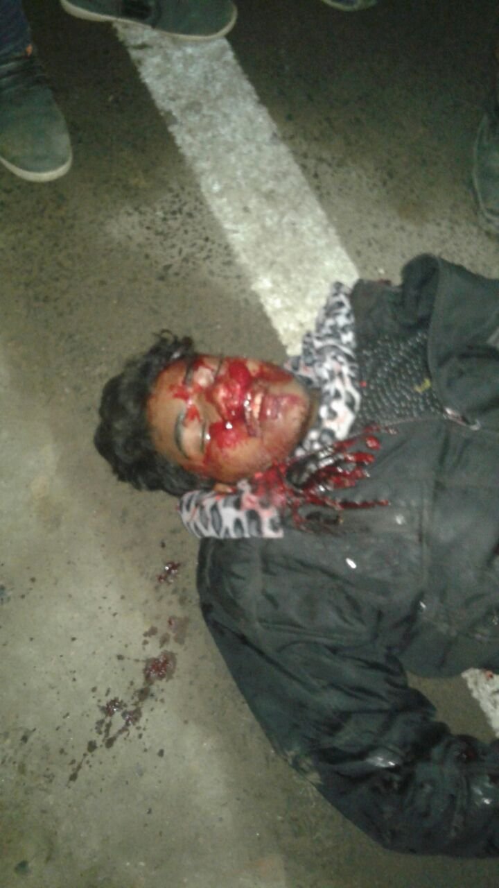 ट्रक की चपेट में आने से मोटर साइकल सवार गंभीर रूप घायल | New India Times