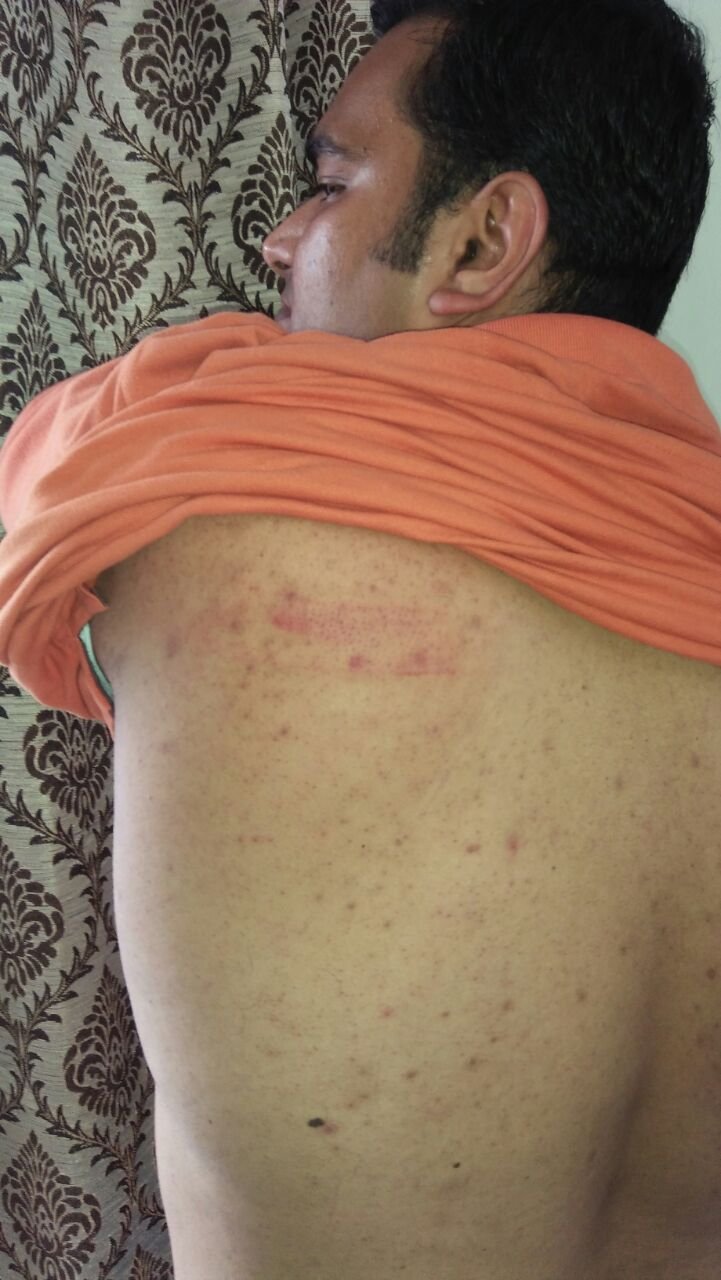 गोहद सिविल अस्पताल में घुस कर की डाॅक्टर की पिटाई, पीडित डॉक्टर ने अपने ही साथी डॉक्टर पर लगाया पिटाई करवाने का आरोप | New India Times