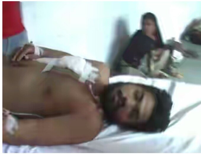 झांसी शहर में 50 हजार रुपये रंगदारी न देने पर मारी गोली | New India Times