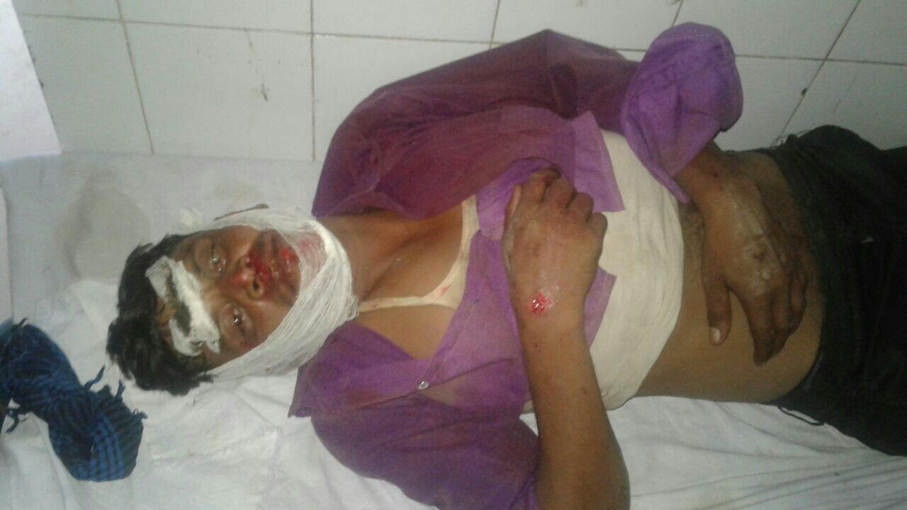 सीतापुर जिला के बिसवां मार्ग की सड़क में गड्ढों की भरमार, खराब सड़क के कारण दो मोटरसाइकिलों की आमने-सामने की हुई टक्कर, तीन सवार घायल | New India Times