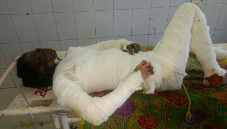 दहेज उत्पीडन से तंग विवाहिता ने खुद को किया आग के हवाले,  इलाज के दौरान अस्पताल में हुई मौत | New India Times