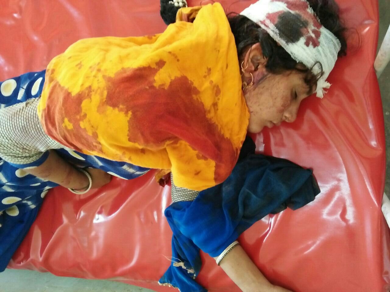 बहन से शादी करने से मना करने पर देवर ने गर्भवती भाभी व उसकी मां पर किया प्राण घातक हमला | New India Times