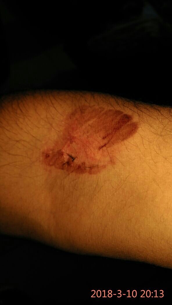 बाइक खडा करने के विवाद में खूनी संघर्ष 3 बाइक खडा करने के विवाद में खूनी संघर्ष | New India Times