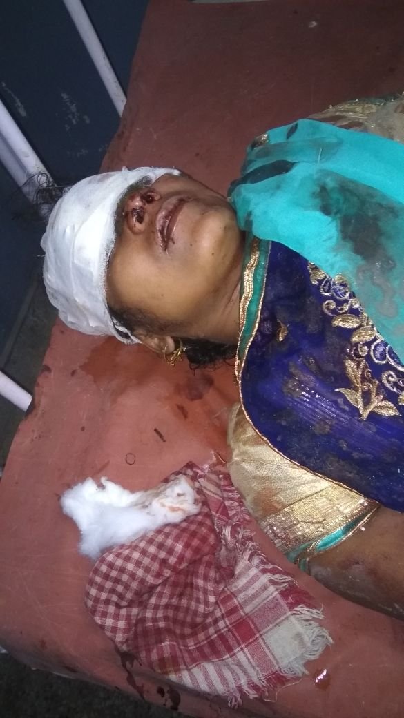 यूपी के लखीमपुर खीरी जिला में अलग अलग हुए दो सडक दुर्घटना में दर्जनों घायल | New India Times