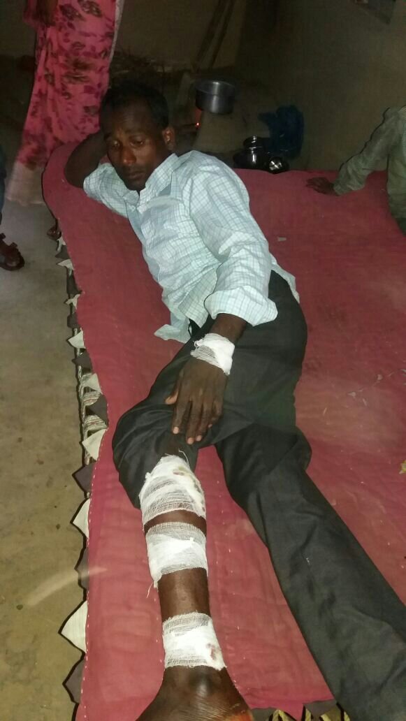 शौच को गए ग्रामीण पर मगरमच्छ ने किया हमला | New India Times