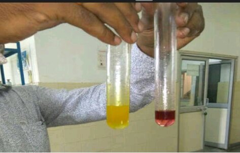 खुले में बिकने वाले नारियल व अन्य खाद्य तेलों में 85 प्रतिशत तक मिलावट
, कंज्यूमर ऑर्गनाइजेशन कंज्यूमर वॉयस द्वारा किये गये शोध में हुआ खुलासा  | New India Times