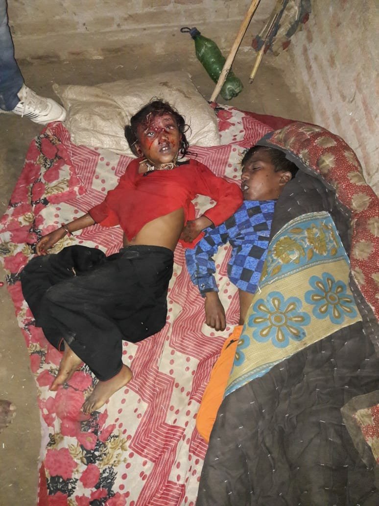 मेलार्थियों से भरी ट्रैक्टर-ट्राली पलटी, दो मासूमों की मौत दर्जनों घायल | New India Times