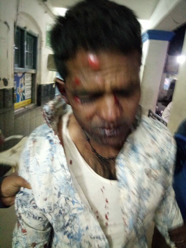 राष्ट्रीय मानवाधिकार आयोग ने घायल सुनील का उपचार करवा कर पेश की मानवता की मिसाल | New India Times