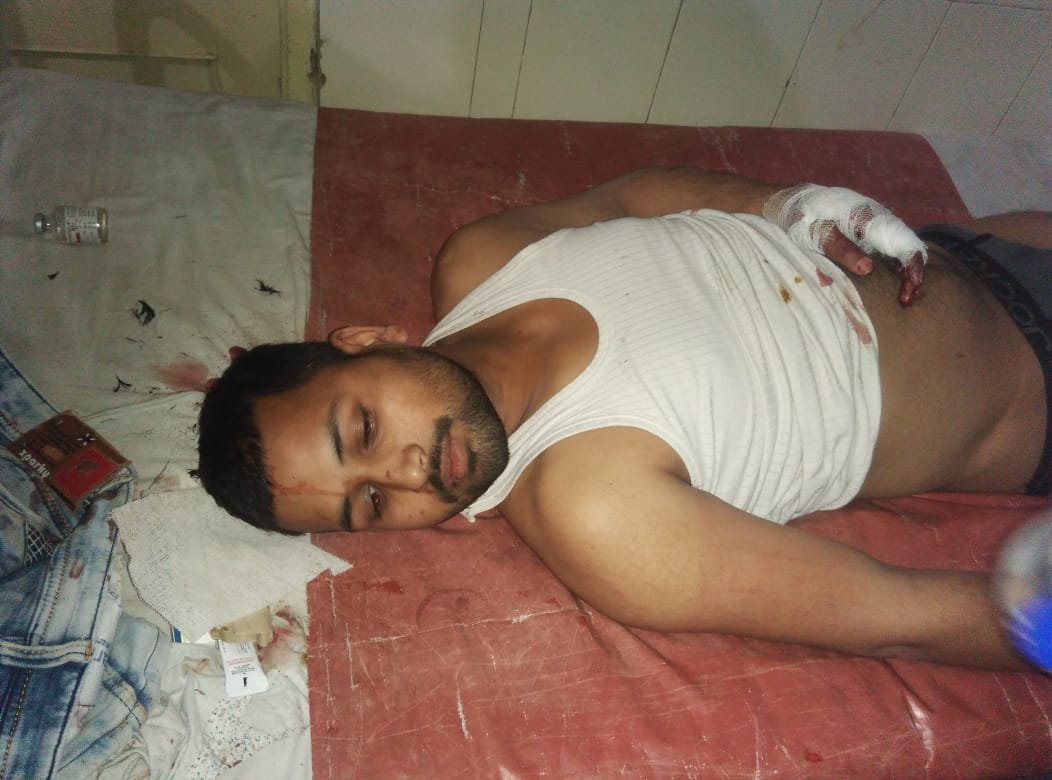 बीएससी की परिक्षा देकर लौट रहे छात्र की अज्ञात लोगों ने की पिटाई | New India Times