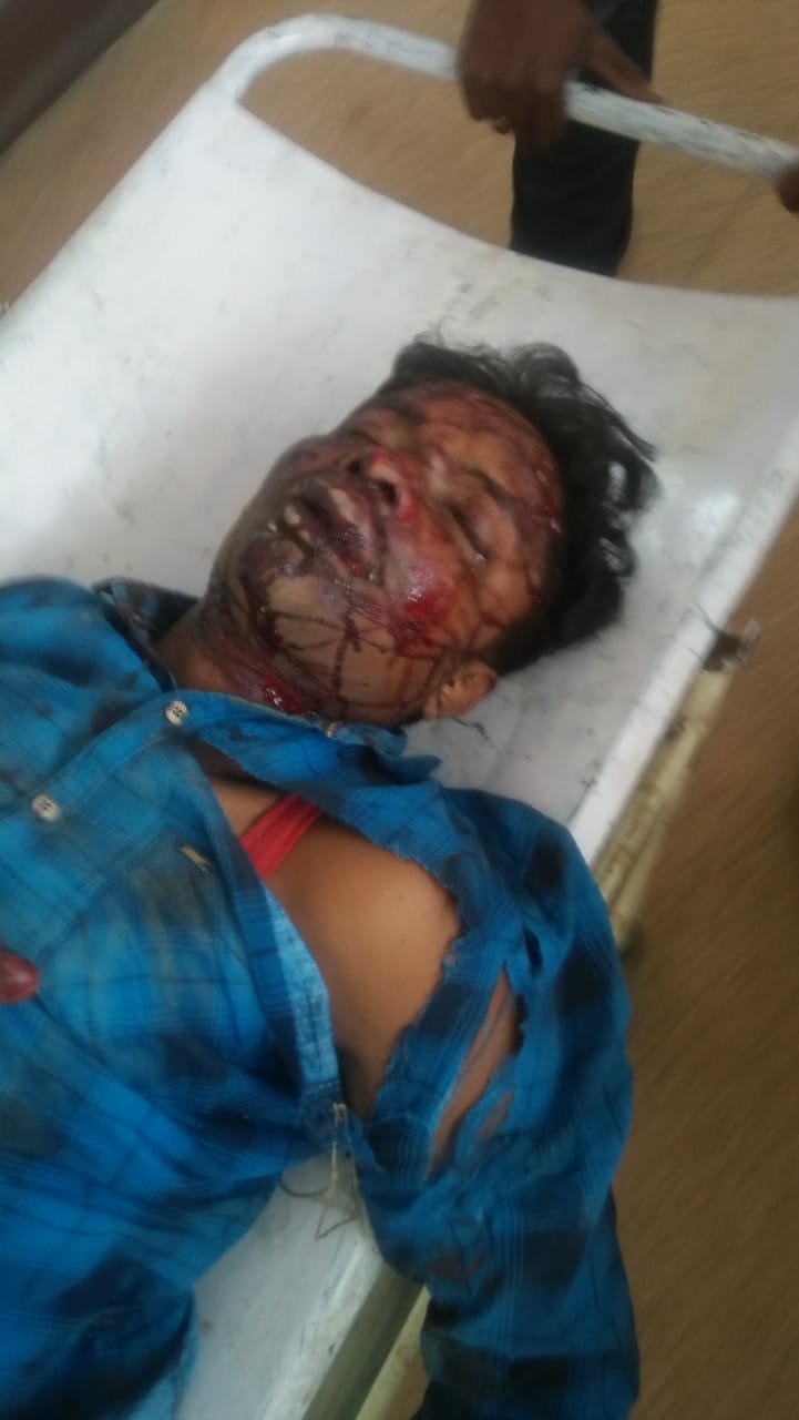 कार और मोटरसाइकिल की टक्कर में बाइक सवार एक की मौत दूसरा घायल 3 कार और मोटरसाइकिल की टक्कर में बाइक सवार एक की मौत दूसरा घायल | New India Times