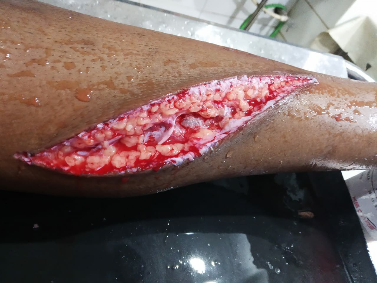 एक तो ब्लेड वाले तार, दूजे रास्ता है बेकार, जिम्मेदार बने गैर जिम्मेदार, अब जनता किससे करे मनुहार 2 एक तो ब्लेड वाले तार, दूजे रास्ता है बेकार, जिम्मेदार बने गैर जिम्मेदार, अब जनता किससे करे मनुहार | New India Times