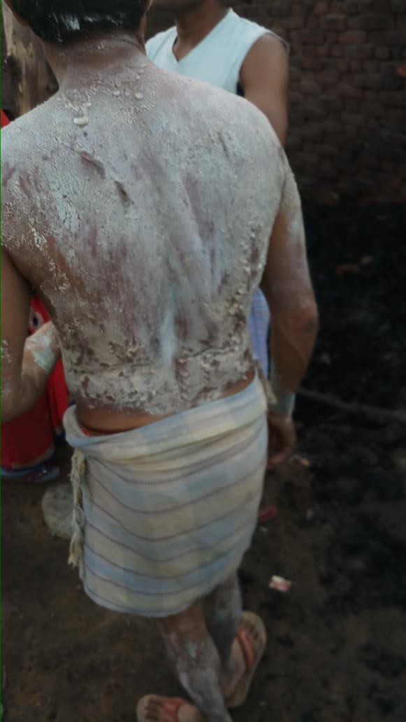 शादी समारोह में छोड़ा गया पटाखा छप्पर पर गिरने से घर में लगी आग, आग में सिलेंडर फटने से लगभग आधा दर्जन मकान भी आये आग की चपेट में | New India Times