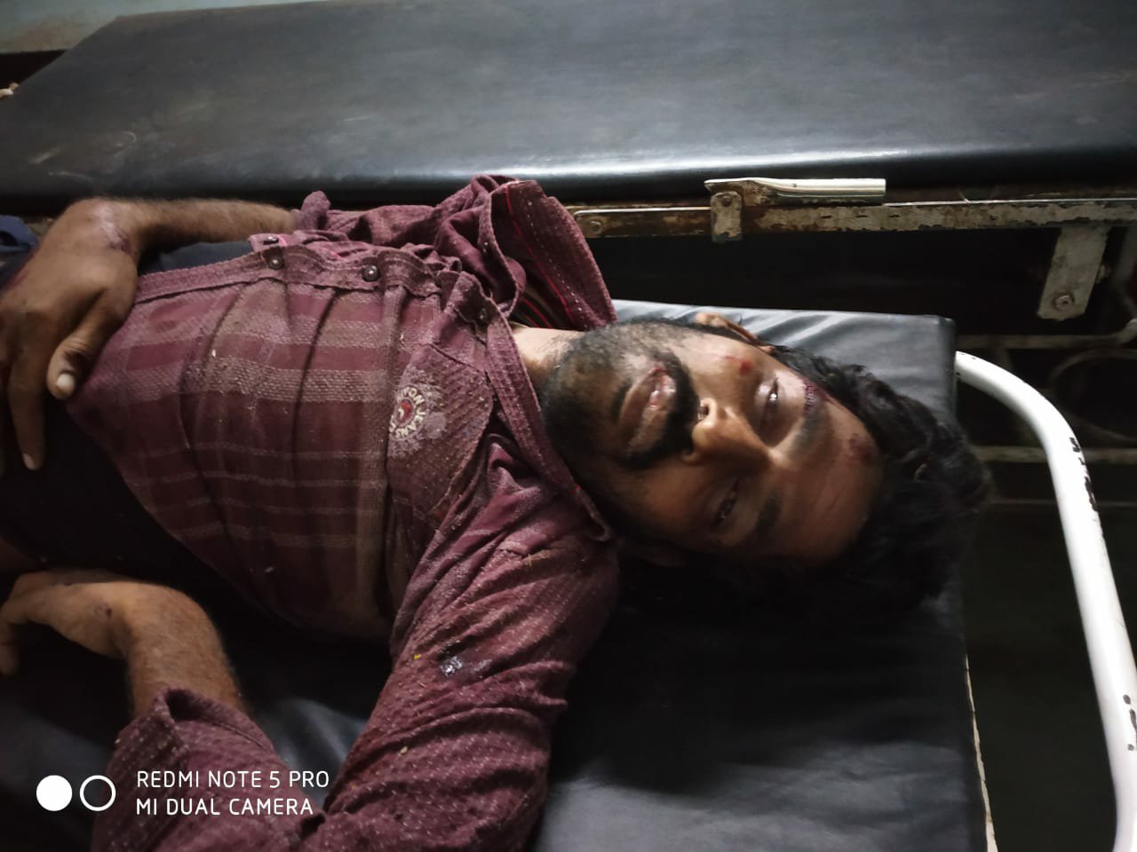 ट्रक और बाइक की टक्कर में ट्रक-बाइक में लगी आग, बाइक सवार तीन लोगों की मौत, ट्रक चालक-क्लीनर फरार | New India Times