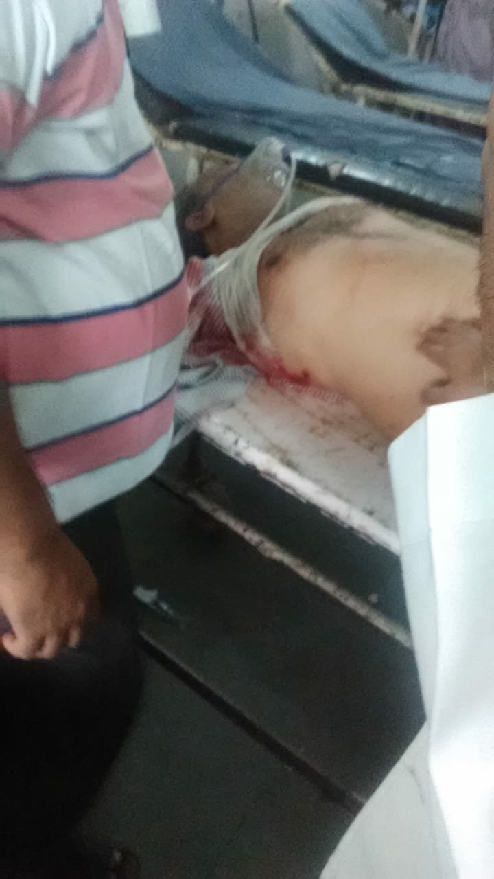 ग्वालियर के विश्वविद्यालय थाना क्षेत्र में बैंक में पैसे जमा करने जा रहे गैस एजेंसी मुनी को दिनदहाड़े गोली मारकर बदमाशों ने की लाखों की लूट | New India Times