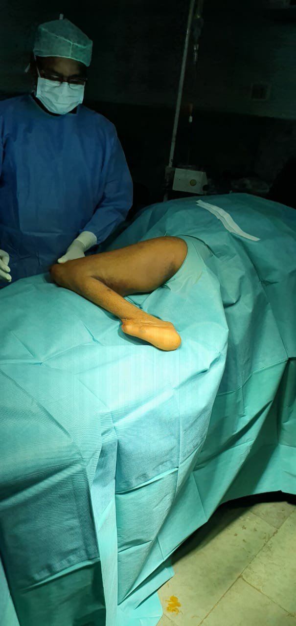 जीवन ज्योति हॉस्पिटल व रोटरी क्लब अपना के तत्वाधान में जारी निःशुल्क प्लास्टिक सर्जरी शिविर इतिहास रचने की ओर है अग्रसर | New India Times