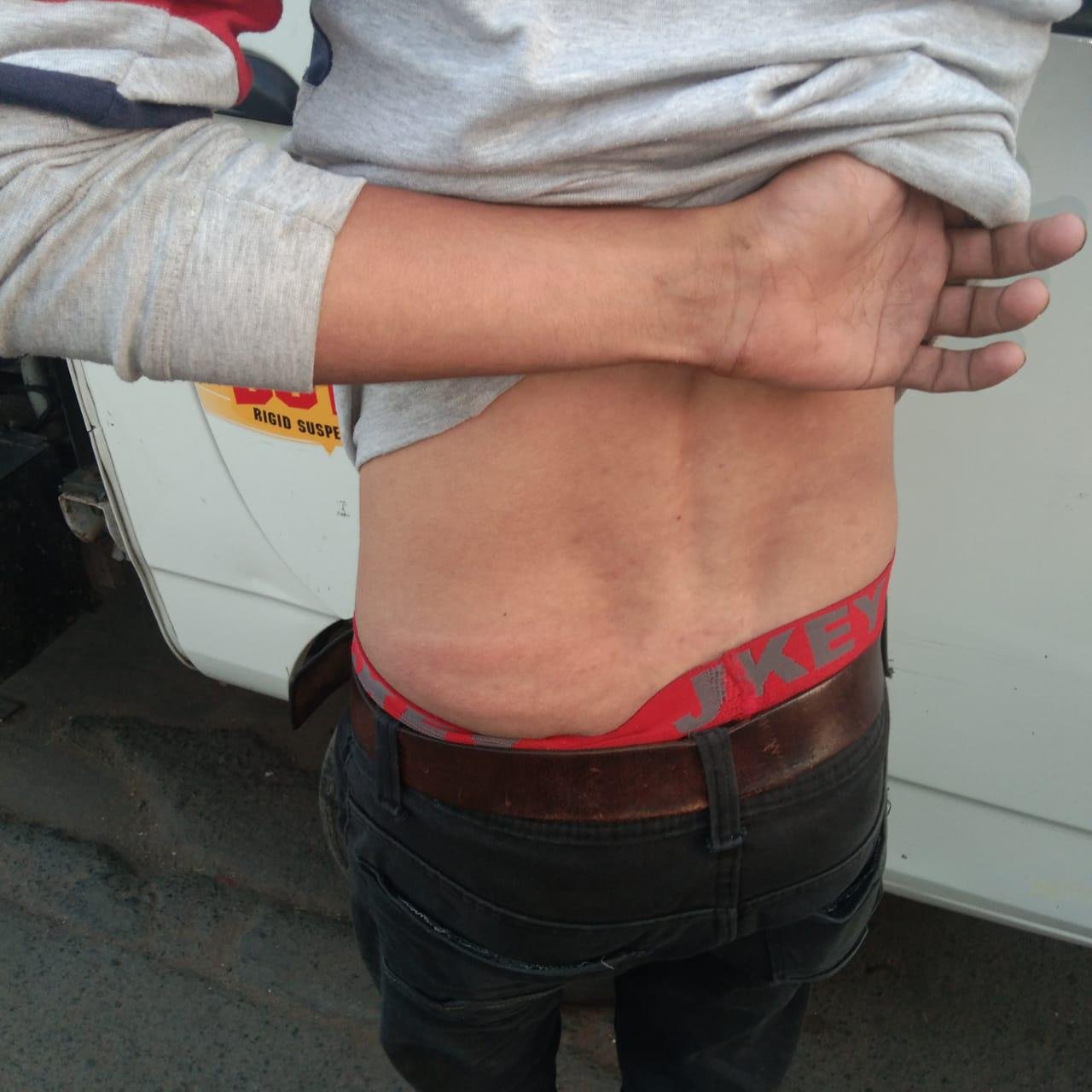 ड्यूटी कर रहे नगर निगम कर्मी पर पुलिस ने बरसाए डंडे | New India Times