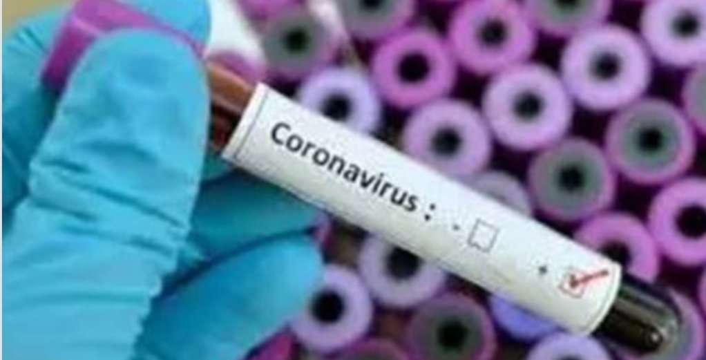 लखनऊ में फिर पाए गए 449 कोरोना पॉजिटिव केस, लगातार बढ़ रही है रोगियों की संख्या | New India Times