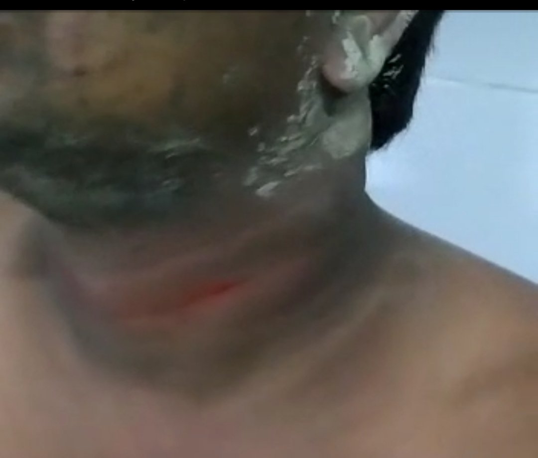 दो पक्षों के मामूली विवाद में की गई एक व्यक्ति की हत्या की कोशिश | New India Times