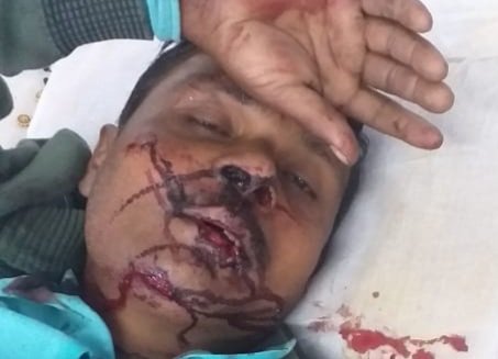 तेज़ रफ़्तार आटो अनियंत्रित हो कर पलटी, ड्राइवर की मौत अन्य पांच घायल, तीन की हालत गंभीर | New India Times