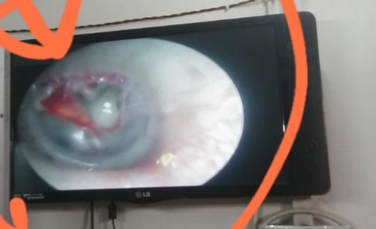 होमवर्क न करने पर टीचर ने मारकर बच्चे के कान का पर्दा फाड़ा | New India Times