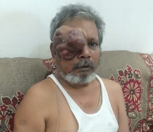 नहीं रुक रहा है आँखों से खून, बिक गई सारी संपत्ति, कर्ज़दार दे रहे है रातों को दरवाज़े पर दस्तक, परिवार आया आत्महत्या की कगार पर | New India Times