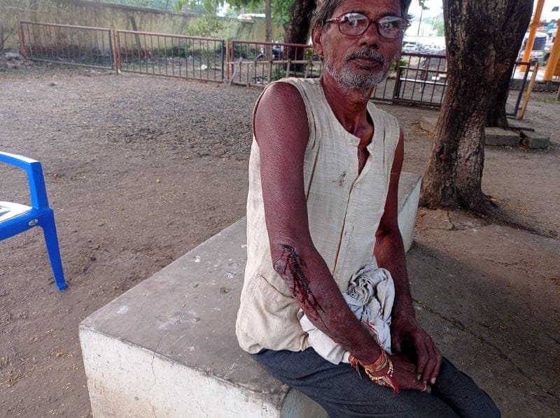 बखरनी से उपजा विवाद खूनी संघर्ष में बदला, दोनों पक्षों के हुए गंभीर घायल | New India Times