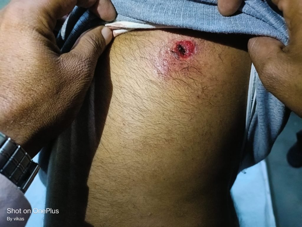 एग्रीकल्चर विभाग के एटीओ को अज्ञात हमलावरों ने मारी गोली | New India Times