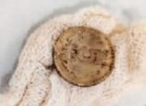 डॉक्टरों ने ऑपरेशन कर निकाला 3 वर्षीय बच्चे के आहार नली में अटका 5 रूपये का सिक्का | New India Times