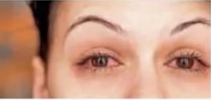 वायरल फीवर और उल्टी-दस्त के मरीजों में इजाफा, आखों के संक्रमण के मरीजों की संख्या में भी होने लगी बढ़ोतरी | New India Times