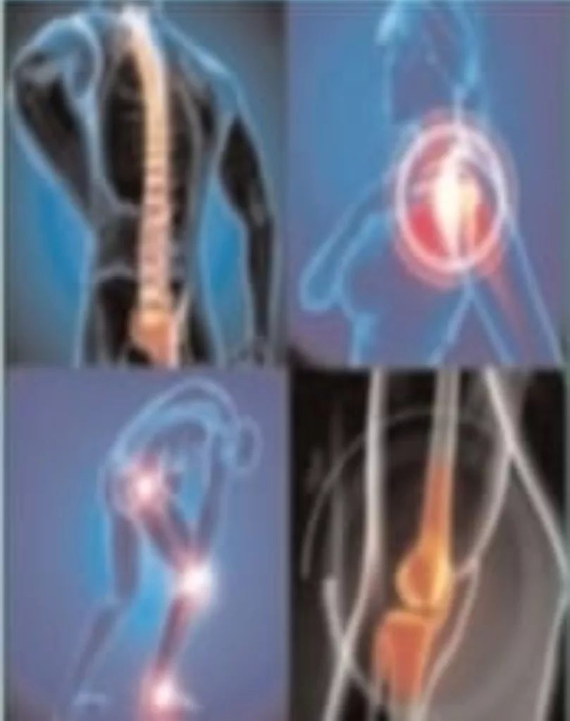 मेघनगर में 6 अगस्त को होगा नि:शुल्क दर्द निवारण शिविर का आयोजन 2 मेघनगर में 6 अगस्त को होगा नि:शुल्क दर्द निवारण शिविर का आयोजन | New India Times