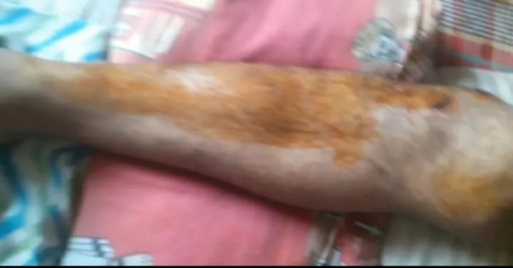 मथुरा के पत्रकार मुकेश कुमार गुप्ता पर हुआ जानलेवा हमला, नामजद एफआईआर दर्ज होने और कई दिन बीत जाने के बाद भी पुलिस ने अब तक नहीं की कोई कार्रवाई | New India Times