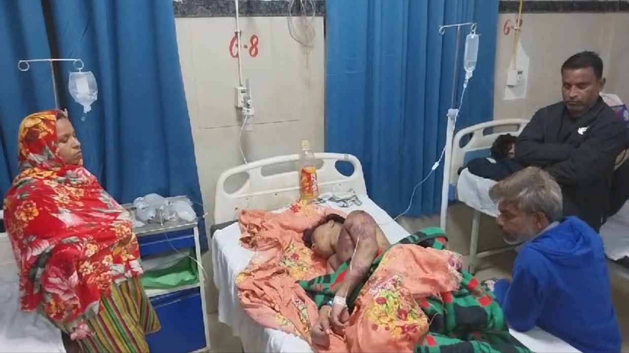 पत्नी से फोन करा किशोर को बुलाया घर, पिटाई के बाद गर्म सरिया से दाग कर सड़क किनारे फेंका 1 पत्नी से फोन करा किशोर को बुलाया घर, पिटाई के बाद गर्म सरिया से दाग कर सड़क किनारे फेंका | New India Times