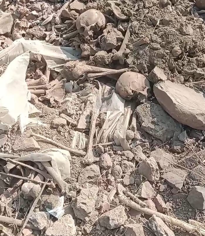 भोपाल के कब्रिस्तानों में नहीं थम रहा है मृतकों के शवों की बेअदबी का सिलसिला, पुराने कब्रों में से हड्डियों का ढेर कचरे में आया नज़र | New India Times