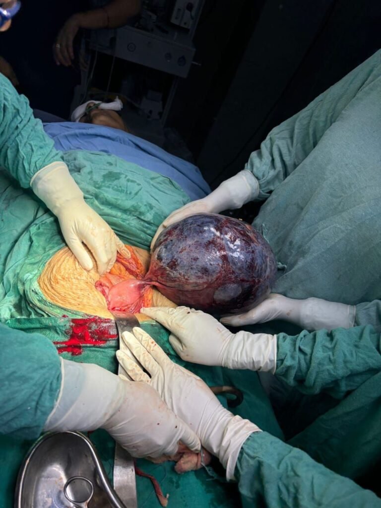 ग्वालियर-झाँसी से निराश लौटी 75 वर्षीय महिला की दतिया में सफल सर्जरी, GMC की टीम ने रचा कीर्तिमान | New India Times