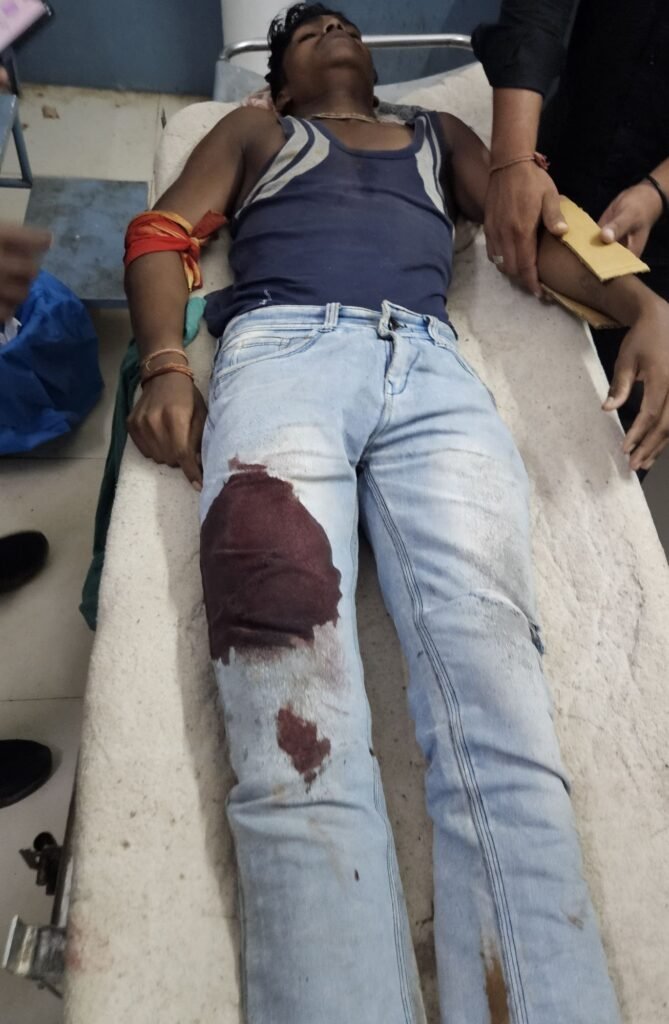 वन सुरक्षा कर्मी पर जानलेवा हमला: मिर्ची पाउडर झोंक कर 6 हमलावरों ने की बेरहमी से पिटाई, सागौन जब्ती का बदला लेने की आशंका | New India Times