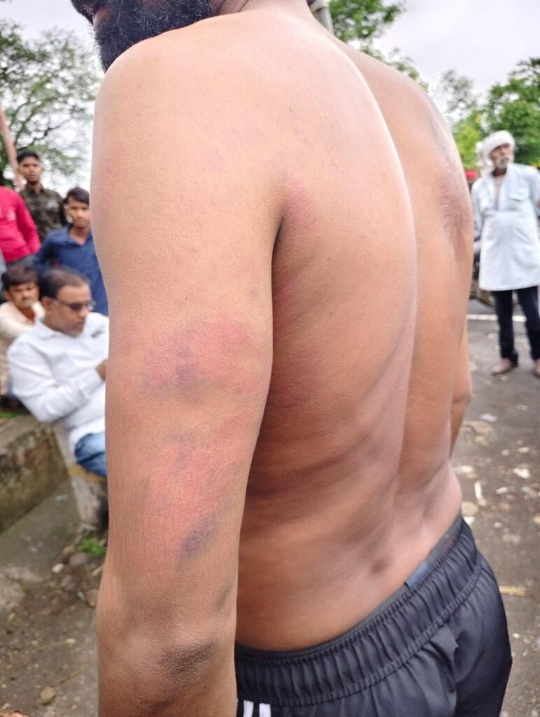 अस्पताल परिसर में नशे में धुत पुलिसकर्मियों ने की बेरहमी से पिटाई, कार्रवाई की मांग को लेकर एसडीओपी को सौंपा गया ज्ञापन | New India Times