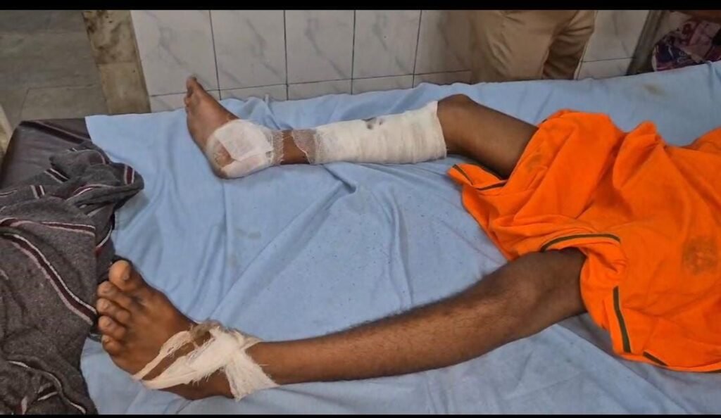 दिल्ली से लौट रहे युवक पर दबंगों का हमला, हाथ-पैर तोड़े – पुलिस तीन दिन से खामोश | New India Times