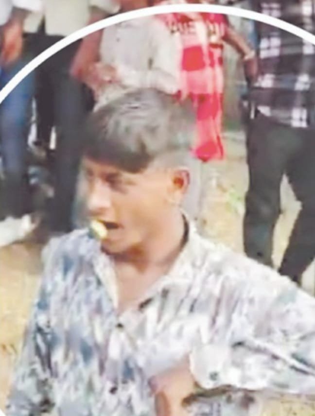 हीरोगिरी पड़ी भारी: मुंह में सुतली बम फोड़ते समय 18 वर्षीय युवक गंभीर रूप से घायल, जबड़ा उड़ा 1 हीरोगिरी पड़ी भारी: मुंह में सुतली बम फोड़ते समय 18 वर्षीय युवक गंभीर रूप से घायल, जबड़ा उड़ा | New India Times