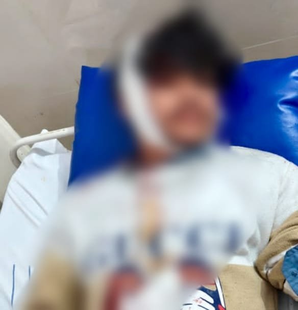 पुरानी रंजिश को लेकर युवक पर प्राण घातक हमला, सर और हाथ में गंभीर चोट, पुलिस ने मामला दर्ज कर जांच की शुरू | New India Times
