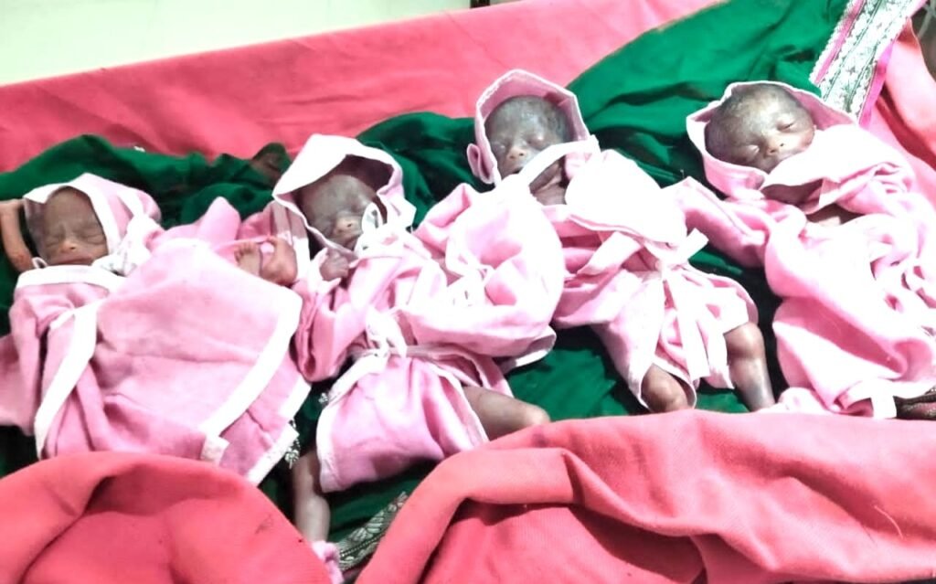 जुन्नारदेव के इतिहास में पहली बार नॉर्मल डिलीवरी में एक महिला ने चार बच्चों को दिया जन्म, दो बच्चों की मौत 2 जुन्नारदेव के इतिहास में पहली बार नॉर्मल डिलीवरी में एक महिला ने चार बच्चों को दिया जन्म, दो बच्चों की मौत | New India Times