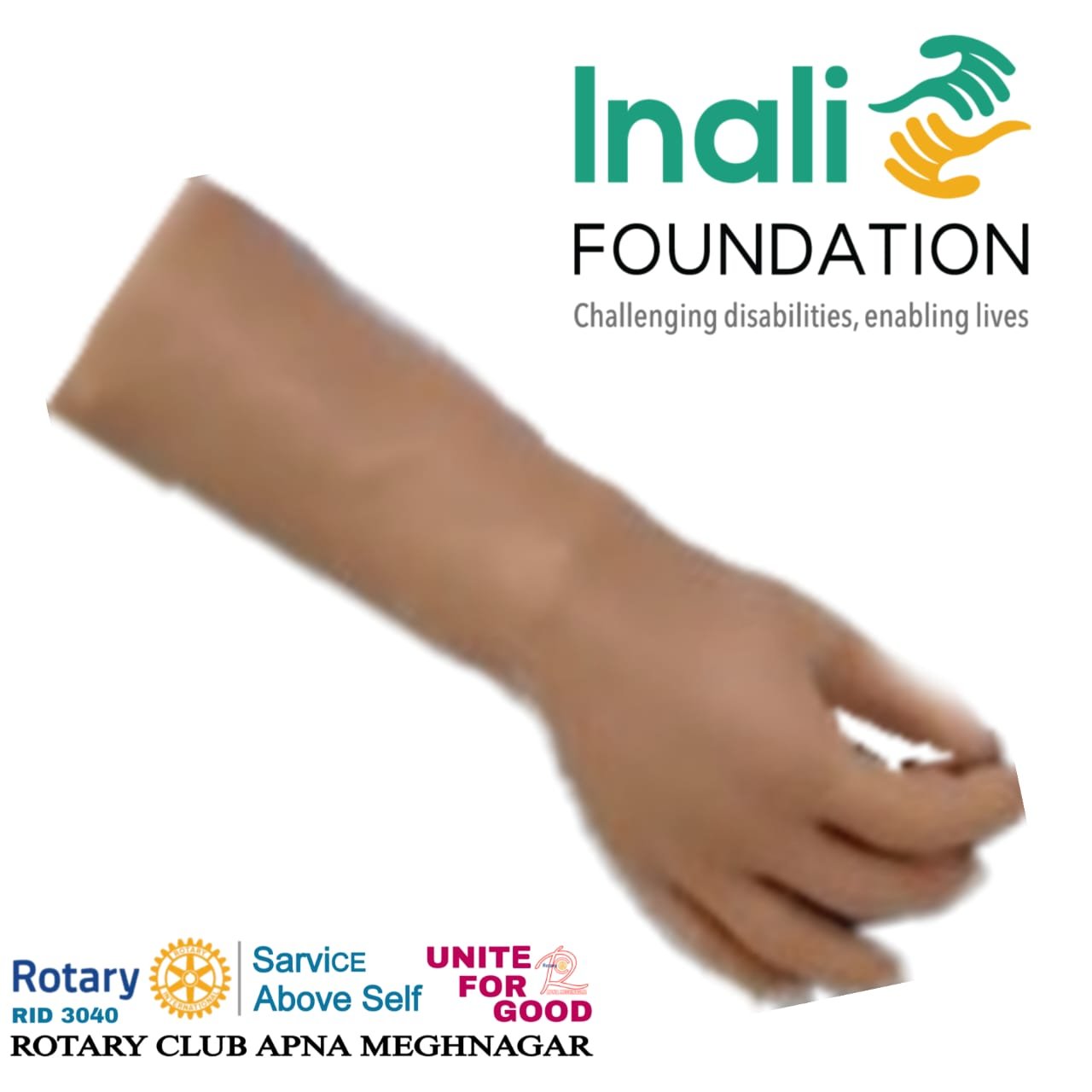 मेघनगर में नि:शुल्क बैटरी चलित कृत्रिम हाथ शिविर — रोटरी क्लब और इनाली फाउंडेशन का संयुक्त प्रयास | New India Times