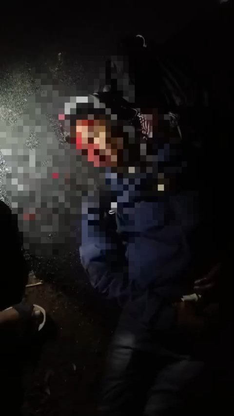 पांडूपिपरिया में निर्माण कार्य की अनदेखी, सड़क पर पड़े पत्थरों से हुआ बड़ा हादसा | New India Times