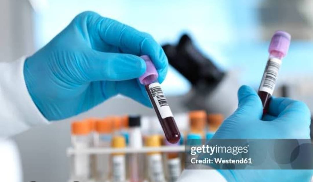 मध्य प्रदेश में 180 करोड़ के पैथोलॉजी टेंडर पर सवाल: 81% डिस्काउंट ने उठाई गुणवत्ता और पारदर्शिता की चिंता | New India Times