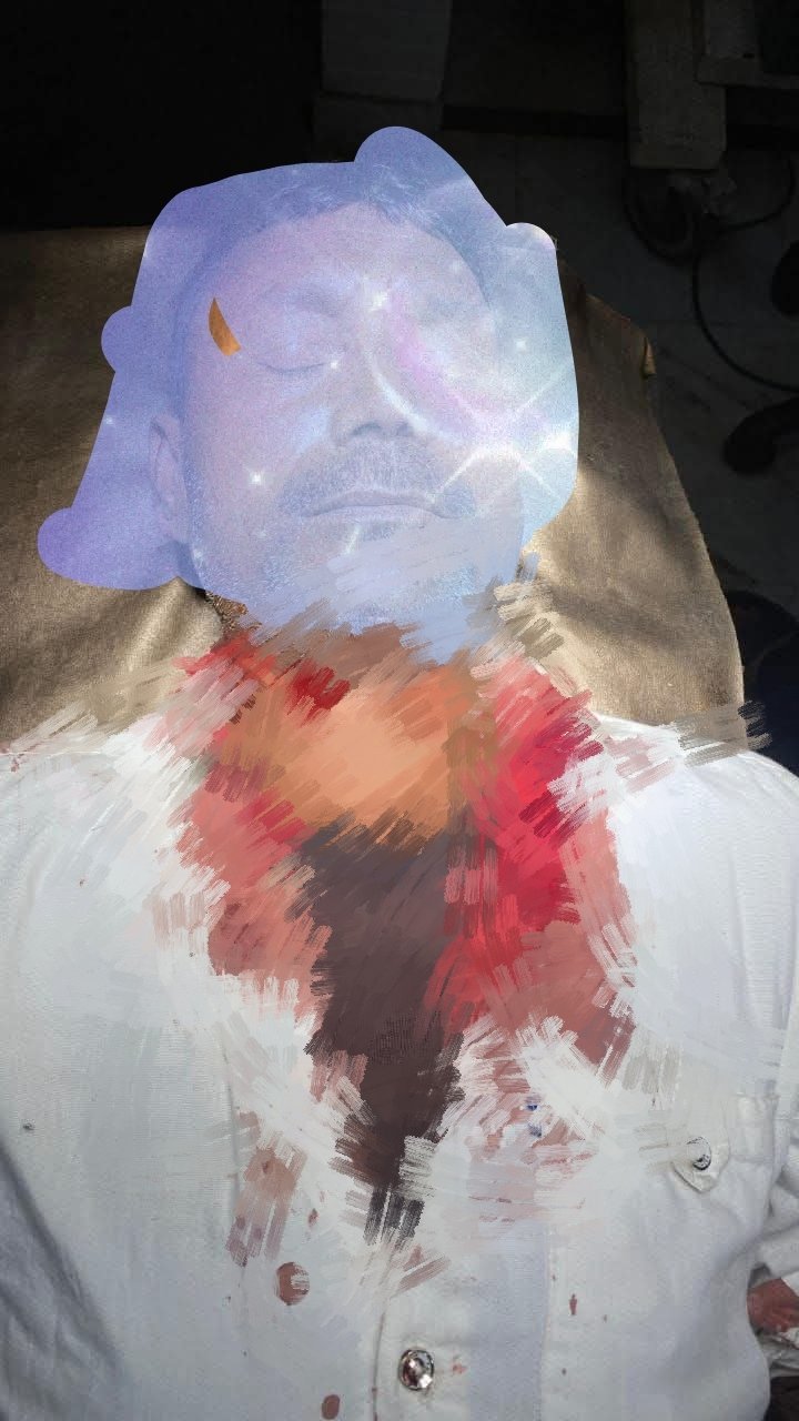 चाइनीज मांझे की चपेट में आकर बाइक सवार घायल, प्रशासन के दावों पर उठे सवाल | New India Times