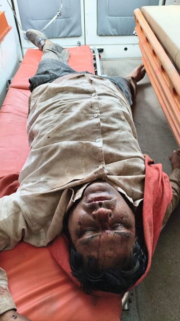 नागिन मोड़ पर भीषण सड़क हादसा, 108 एम्बुलेंस टीम की तत्परता से बची घायल की जान | New India Times