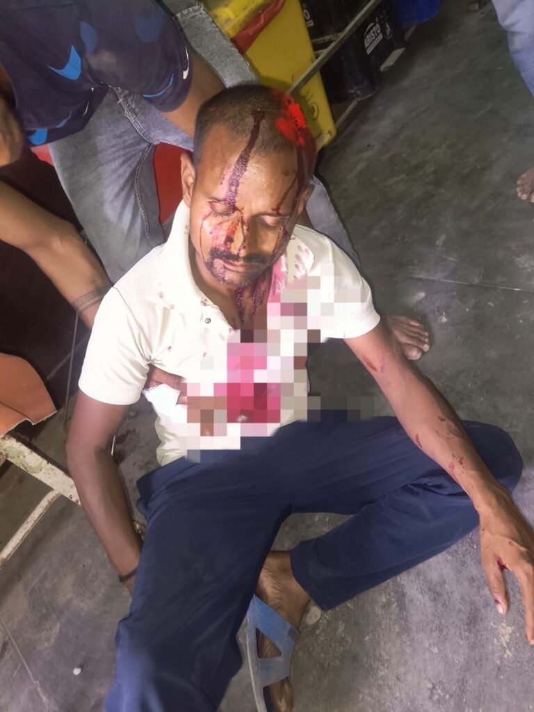 गन्ने के खेत से ट्रैक्टर निकालने को लेकर खूनी संघर्ष, लाठी-डंडे व कुदाल चले, आधा दर्जन घायल 2 गन्ने के खेत से ट्रैक्टर निकालने को लेकर खूनी संघर्ष, लाठी-डंडे व कुदाल चले, आधा दर्जन घायल | New India Times