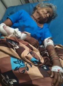 पागल कुत्ते की दहशत: पांच गांवों में कुत्ते के हमले से महिला समेत 15 लोग और कई मवेशी घायल