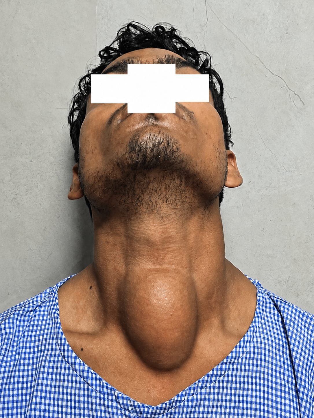 लखीमपुर मेडिकल कॉलेज में गले की जटिल गांठ की सफल सर्जरी, मरीज को मिला नया जीवन | New India Times