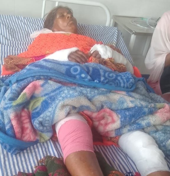 तेज़ रफ्तार बाइक की टक्कर से दो बुजुर्ग महिलाएं गंभीर घायल, इलाज का खर्च देने से मुकरने का आरोप 1 तेज़ रफ्तार बाइक की टक्कर से दो बुजुर्ग महिलाएं गंभीर घायल, इलाज का खर्च देने से मुकरने का आरोप | New India Times